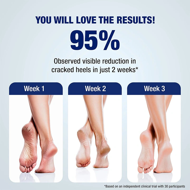 Lunaris 20% Urea Foot Cream Roll On - 50ml | For Dry, Cracked Or Calloused Foot Skin Repair | With 2% Lactic Acid, Olive Oil & Vitamin E | Helps Moisturise & Exfoliates Dead Skin | Non Greasy