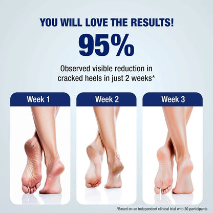 Lunaris 20% Urea Foot Cream Roll On - 50ml | For Dry, Cracked Or Calloused Foot Skin Repair | With 2% Lactic Acid, Olive Oil & Vitamin E | Helps Moisturise & Exfoliates Dead Skin | Non Greasy